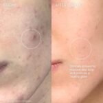 Augustinus Bader The Cream – Luxury Face Cream – Hydrating and Nourishing Face Moisturizer – Facial Moisturizer for Wrinkle Reduction and Cellular Renewal – For Men and Women - Image 5