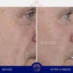 Augustinus Bader The Serum – Luxury Hydrating Anti-Aging Face Serum – Boosts Firmness, Smooths Fine Lines & Evens Skin Tone – Lightweight, Fast-Absorbing Formula – 30 ml / 1 fl oz - Image 3