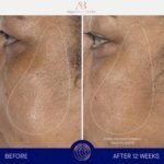 Augustinus Bader The Serum – Luxury Hydrating Anti-Aging Face Serum – Boosts Firmness, Smooths Fine Lines & Evens Skin Tone – Lightweight, Fast-Absorbing Formula – 30 ml / 1 fl oz - Image 5