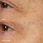 Clinique Smart Clinical Repair Anti Aging Overnight Recovery Face Cream + Mask For All Skin Types | With Hyaluronic Acid + Peptides | Hydrating | Repairs Lines + Wrinkles, 1.7 Fl Oz - Image 4