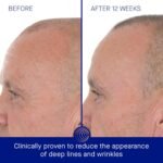 Augustinus Bader The Retinol Serum – Luxury Anti-Aging Face Serum – Smooths Fine Lines, Boosts Firmness & Radiance – Hydrating, Restorative & Skin-Friendly Formula - Image 4