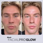 Shark FacialPro Glow at-Home Hydro-Powered Facial System with DePuffi Hot & Cold Therapy – Professional Spa Skincare Device for Pore Cleansing, Hydration, & Radiant Glow, Blue, FH320 - Image 13