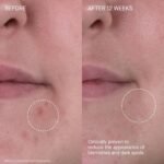 Augustinus Bader The Rich Cream – Luxury Face Cream – Hydrating and Nourishing Face Moisturizer – Facial Moisturizer for Wrinkle Reduction and Cellular Renewal – For Men and Women - Image 5