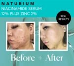 Naturium Niacinamide Face Serum 12% Plus Zinc 2%, Anti-Aging, Pore Minimizer & Dark Spot Corrector with Hyaluronic Acid & Vitamin E, Vegan & Cruelty-Free, 1 oz - Image 5