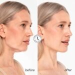 MAREE V Line Lifting Mask with 24K Gold – Deep Collagen Face Mask for Women – Jawline Shaper Mask with Retinol & Hyaluronic Acid – Neck Tightening & Firming - Double Chin Strap for Face Lift - Image 5