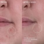 Augustinus Bader The Rich Cream – Luxury Face Cream – Hydrating and Nourishing Face Moisturizer – Facial Moisturizer for Wrinkle Reduction and Cellular Renewal – For Men and Women - Image 5